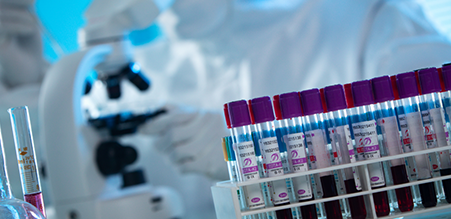 希瑪眼科中心_乾性黃斑病變